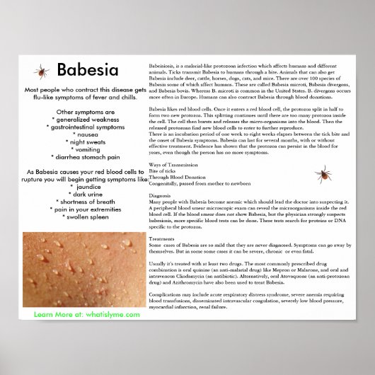 Babesia Symptomen en Poster van overdracht (Voorkant)