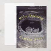 Baby Aankondiging (Voorkant / Achterkant)