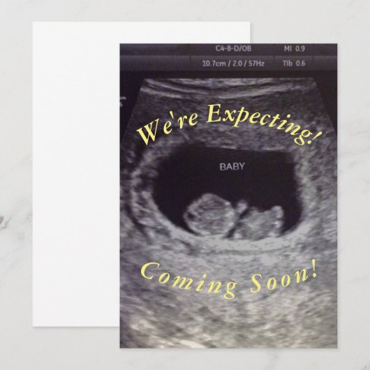 Baby Aankondiging (Voorkant / Achterkant)