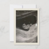 Baby Aankondiging (Achterkant)