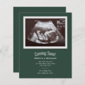 Baby Binnenkort echografie zwangerschapsaankondigi (Voorkant / Achterkant)