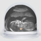 Baby Binnenkort verkrijgbaar Sonogram Gold Heart Sneeuwbol (Voorkant)
