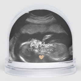 Baby Binnenkort verkrijgbaar Sonogram Gold Heart Sneeuwbol
