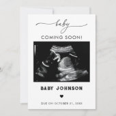 Baby Binnenkort verkrijgbaar Sonogram zwangerschap Kaart (Voorkant)