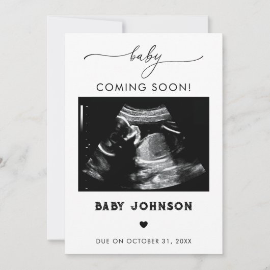 Baby Binnenkort verkrijgbaar Sonogram zwangerschap Kaart (Voorkant)