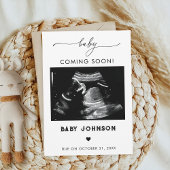 Baby Binnenkort verkrijgbaar Sonogram zwangerschap Kaart