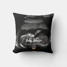Baby Binnenkort verkrijgbaar Ultrasound Gold Heart
