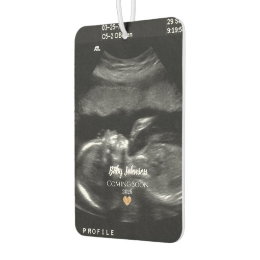 Baby Binnenkort verkrijgbaar Ultrasound Gold Heart Luchtverfrisser (Links)
