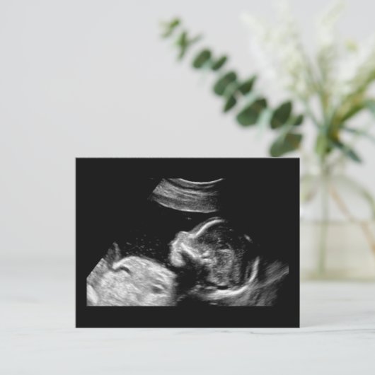 Baby Briefkaart (Staand voorkant)