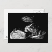 Baby Briefkaart (Voorkant / Achterkant)