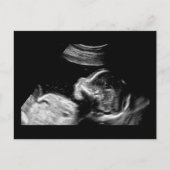 Baby Briefkaart (Voorkant)