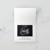 baby-bump echography aankondiging verwacht (Binnen)