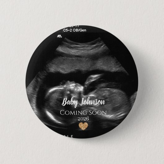 Baby Coming Soon Ultrasound Gold heart  Ronde Button 5,7 Cm (Voorkant)