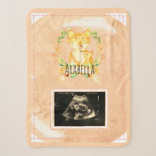 Baby Fox Custom Ultrasound Afbeelding Sherpa Blank Deken (Voorkant)