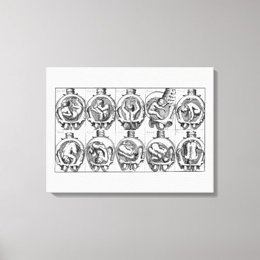 Baby in baarmoeder  vroedvrouw anatomie illustrati canvas afdruk (Voorkant)