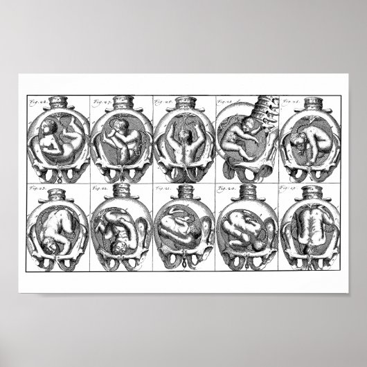Baby in baarmoeder  vroedvrouw anatomie illustrati poster (Voorkant)