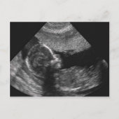 baby, kaart (Voorkant)