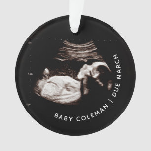 Baby kerstornament Zwangerschap Ultrasound Foto Ornament