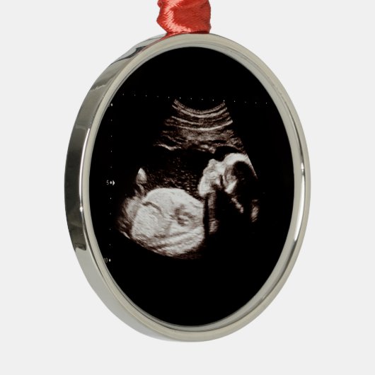 Baby kerstzwangerschap Ultrasone fotoserie Metalen Ornament (Rechts)