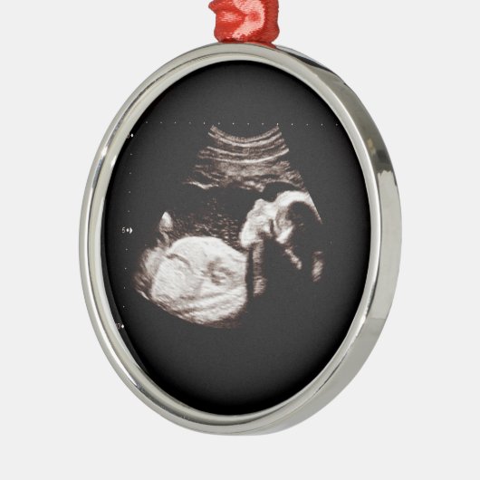 Baby kerstzwangerschap Ultrasone fotoserie Metalen Ornament (Links)