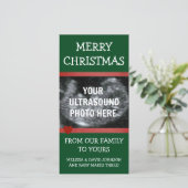 Baby on The Way Christmas Ultrasound Feestdagenkaart (Staand voorkant)