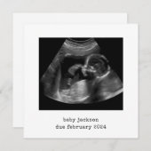 Baby Scan Foto Aankondiging Kaart (Voorkant / Achterkant)