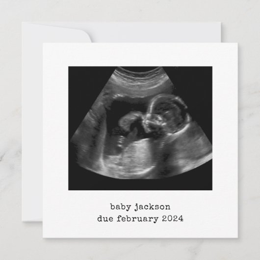 Baby Scan Foto Aankondiging Kaart (Voorkant)