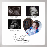 Baby Scan Fotosonogram pasgeborene baby keepsake