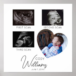 Baby Scan Fotosonogram pasgeborene baby keepsake Poster