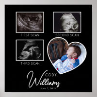 Baby Scan Fotosonogram pasgeborene baby keepsake
