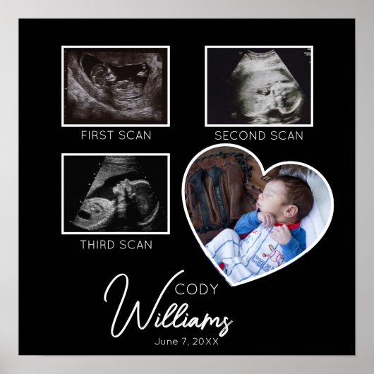 Baby Scan Fotosonogram pasgeborene baby keepsake Poster (Voorkant)