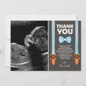 baby shower Dank je creditcard Little Man Echo Bedankkaart (Voorkant)