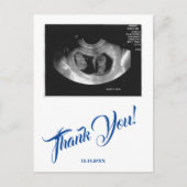 Baby shower echo jongen blauw dank u. briefkaart (Voorkant)