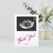 Baby shower echo meisje roze dank u. briefkaart (Staand voorkant)