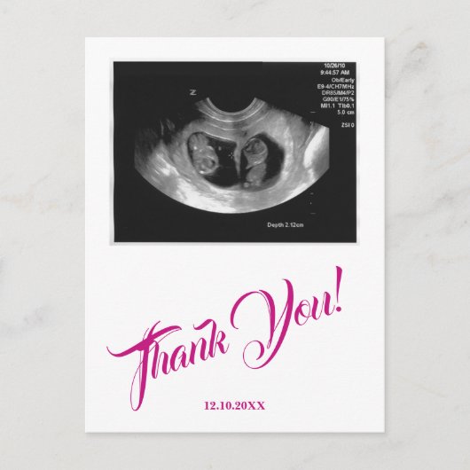 Baby shower echo meisje roze dank u. briefkaart (Voorkant)