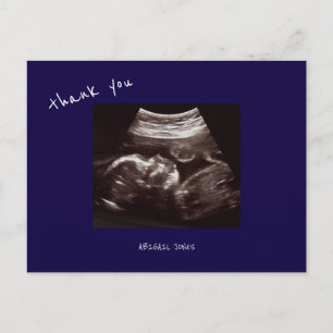 Baby Shower Echografie Schattig Marineblauw Dank J Briefkaart