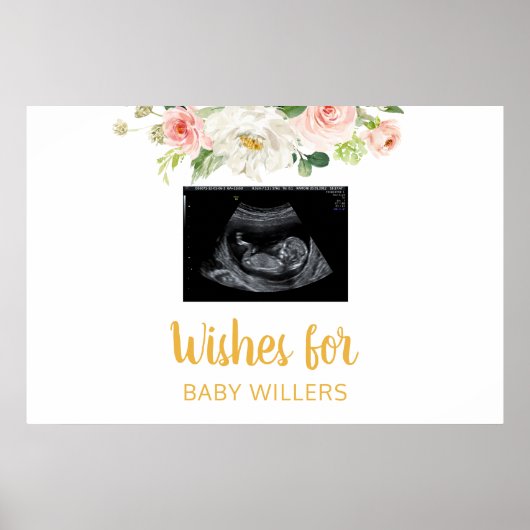 Baby shower Guest Book Sign, Sonogram Ultrasound Poster (Voorkant)