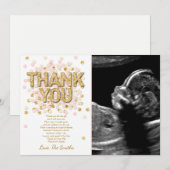 baby shower Hartelijk dank Confetti Gold Roze meis Bedankkaart (Voorkant / Achterkant)