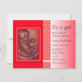 baby shower Invitation Red Ultrasound Kaart (Voorkant)