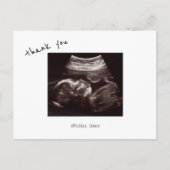 Baby shower Ultrasound Cute Font Dank u Briefkaart (Voorkant)