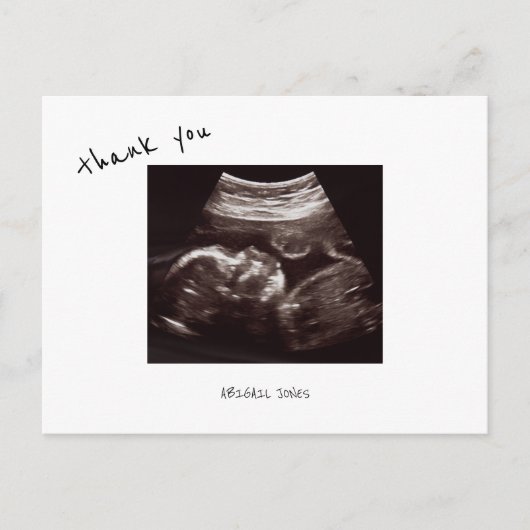 Baby shower Ultrasound Cute Font Dank u Briefkaart (Voorkant)