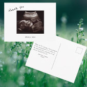 Baby shower Ultrasound Cute Font Dank u Briefkaart