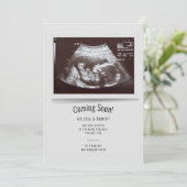 Baby Sonogram Binnenkort bekend (Staand voorkant)