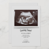 Baby Sonogram Binnenkort bekend (Voorkant / Achterkant)