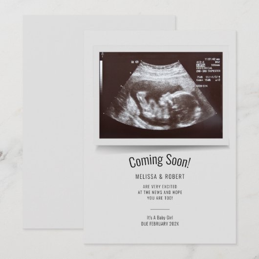 Baby Sonogram Binnenkort bekend (Voorkant / Achterkant)