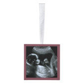 Baby Sonogram Geloof Sparkle Shine 3 Foto Decoratie (Rechts)