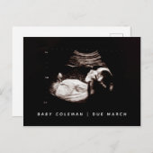 Baby Sonogram Zwangerschap Aankondiging Foto Briefkaart (Voorkant / Achterkant)