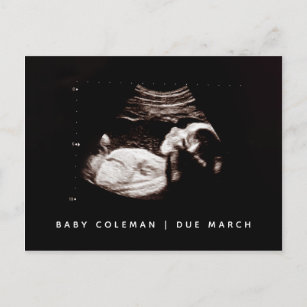 Baby Sonogram Zwangerschap Aankondiging van de aan Briefkaart