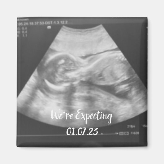 baby ultrasone aankondiging magneet (Voorkant)