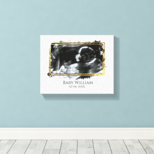 Baby ultrasone Sonogram Afbeelding Verwacht Canvas Afdruk (Insitu (Houten vloer))